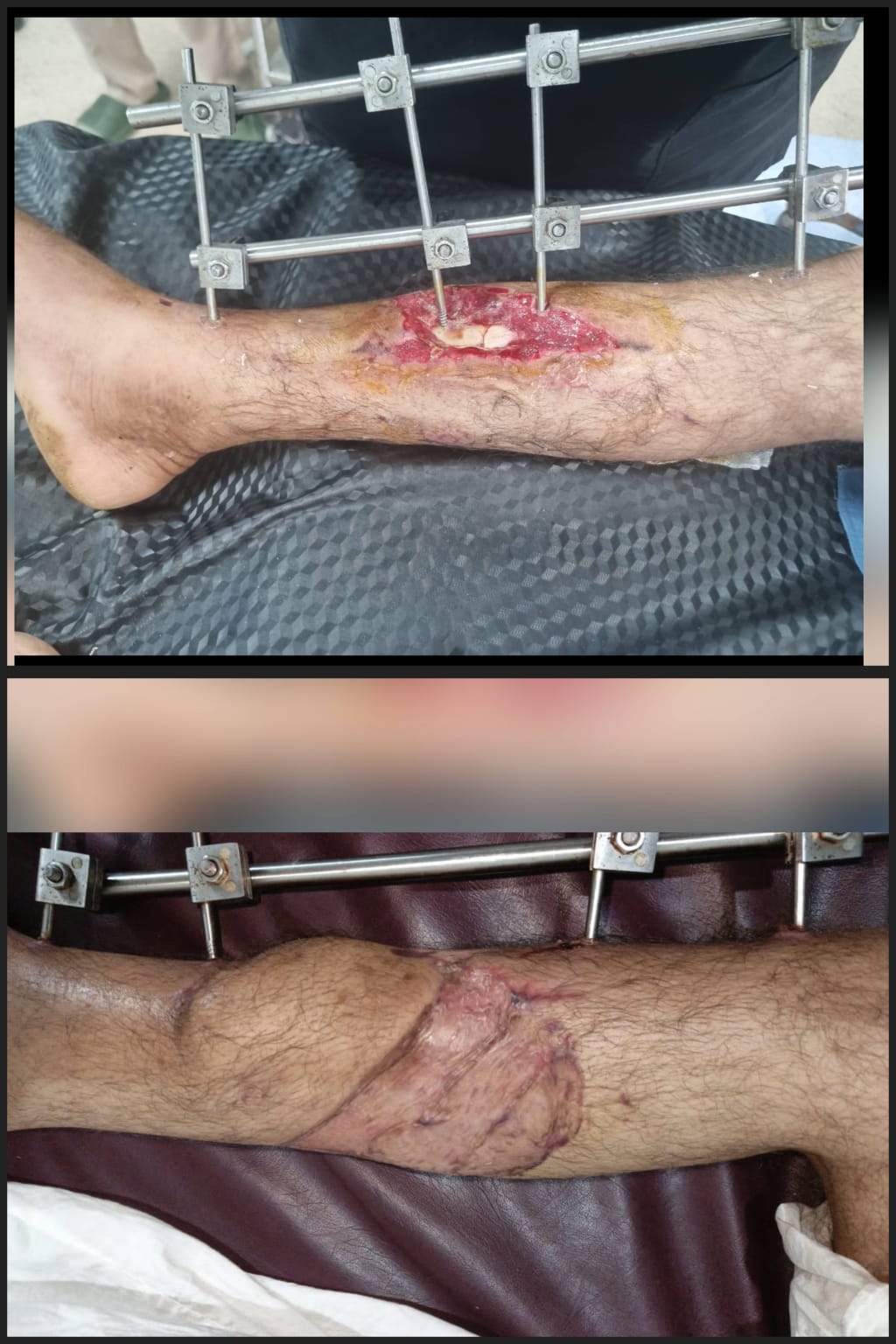 Before & After 55